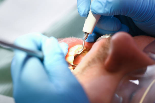 Best Urgent Care for Lost Fillings or Crowns in Kentwood, MI