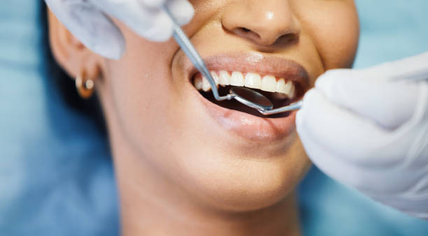 Best Emergency Tooth Extraction in Kentwood, MI